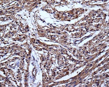 Immunohistochemistry (Formalin/PFA-fixed paraffin-embedded sections) - Anti-VEGFD antibody [EPR8457] (ab155288), expandable thumbnail
