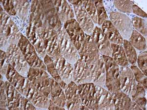 Immunohistochemistry (Formalin/PFA-fixed paraffin-embedded sections) - Anti-VEGFD antibody [EPR8457] (AB155288)