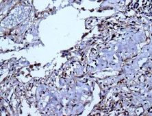 Immunohistochemistry (Formalin/PFA-fixed paraffin-embedded sections) - Anti-VEGFD antibody [EPR8457] (AB155288)