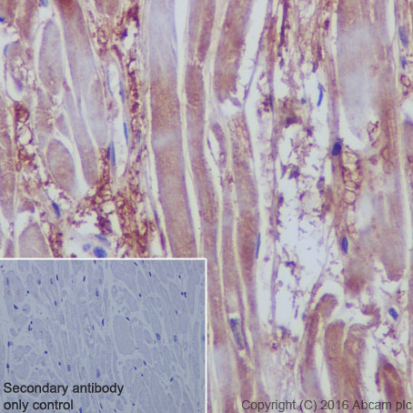 Immunohistochemistry (Formalin/PFA-fixed paraffin-embedded sections) - Anti-VEGFD antibody [EPR8457] (AB155288), expandable thumbnail