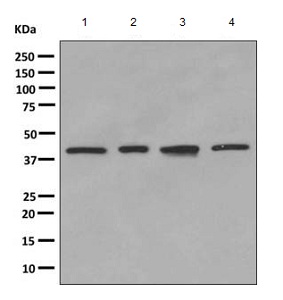 Western blot - Anti-VEGFD antibody [EPR8457] (ab155288), expandable thumbnail