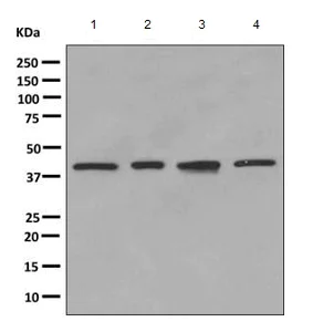 Western blot - Anti-VEGFD antibody [EPR8457] (AB155288)