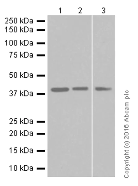 Western blot - Anti-VEGFD antibody [EPR8457] (AB155288)