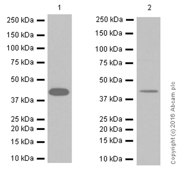 Western blot - Anti-VEGFD antibody [EPR8457] (ab155288), expandable thumbnail