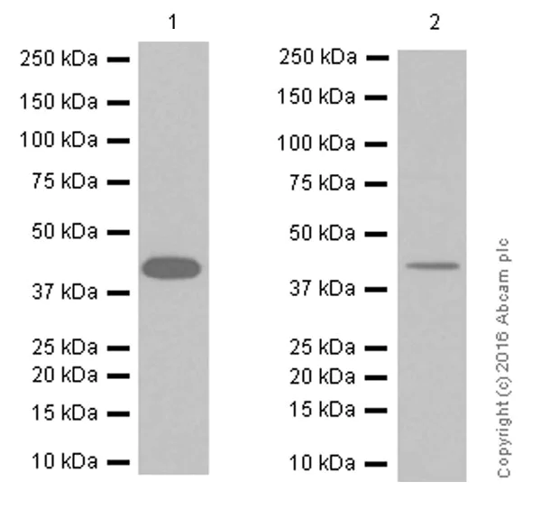 Western blot - Anti-VEGFD antibody [EPR8457] (AB155288)