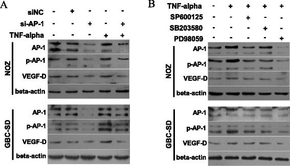 Western blot - Anti-VEGFD antibody [EPR8457] (ab155288), expandable thumbnail