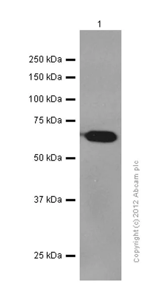 Western blot - Anti-VEGFD antibody [EPR8457] (AB155288)