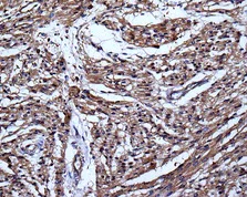 Immunohistochemistry (Formalin/PFA-fixed paraffin-embedded sections) - Anti-VEGFD antibody [EPR8457] - BSA and Azide free (AB232447)