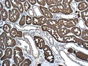 Immunohistochemistry (Formalin/PFA-fixed paraffin-embedded sections) - Anti-VEGFD antibody [EPR8457] - BSA and Azide free (AB232447)