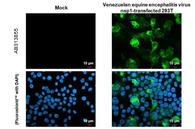 Immunocytochemistry/ Immunofluorescence - Anti-Venezuelan Equine Encephalitis Virus nsp1 antibody [HL1472] - BSA and Azide free (AB313855), expandable thumbnail