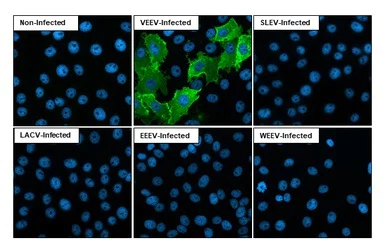 Immunocytochemistry/ Immunofluorescence - Anti-Venezuelan Equine Encephalitis Virus nsp1 antibody [HL1472] - BSA and Azide free (AB313855)