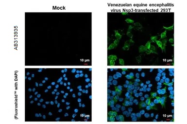 Immunocytochemistry/ Immunofluorescence - Anti-Venezuelan equine encephalitis virus nsp3 antibody [HL1502] - BSA and Azide free (AB313935), expandable thumbnail