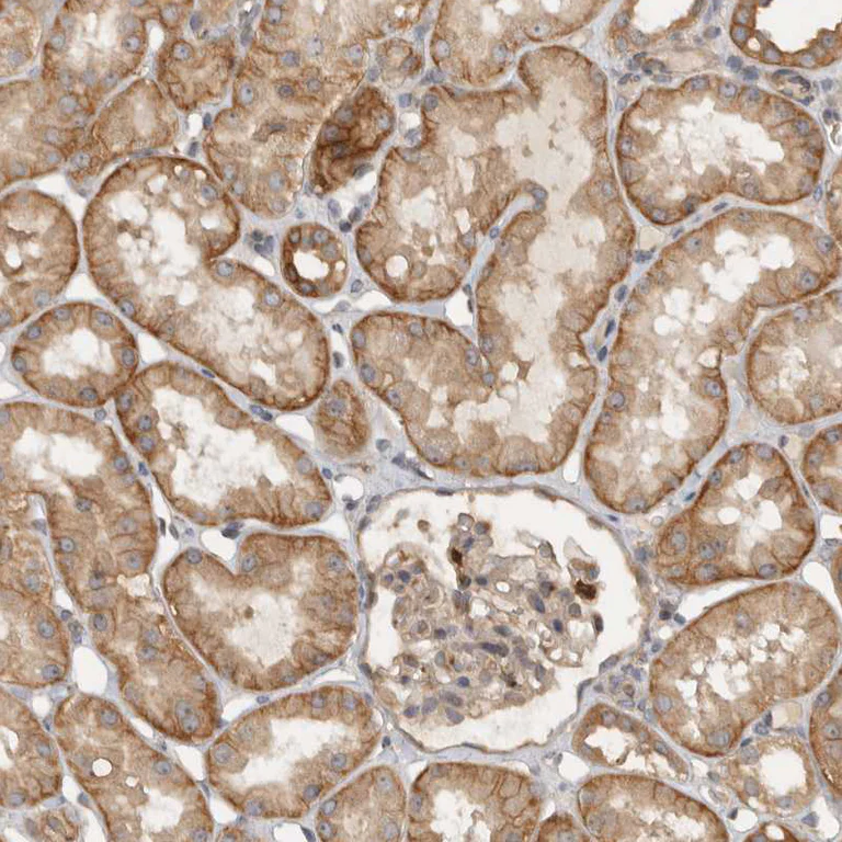 Immunohistochemistry (Formalin/PFA-fixed paraffin-embedded sections) - Anti-VEPH1 antibody (AB121875)