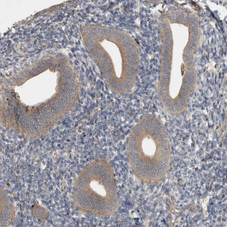 Immunohistochemistry (Formalin/PFA-fixed paraffin-embedded sections) - Anti-VEPH1 antibody (AB121875)