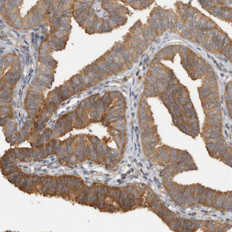 Immunohistochemistry (Formalin/PFA-fixed paraffin-embedded sections) - Anti-VEPH1 antibody (AB121875)