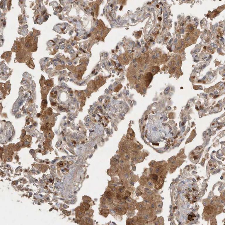 Immunohistochemistry (Formalin/PFA-fixed paraffin-embedded sections) - Anti-VEPH1 antibody (AB121875)
