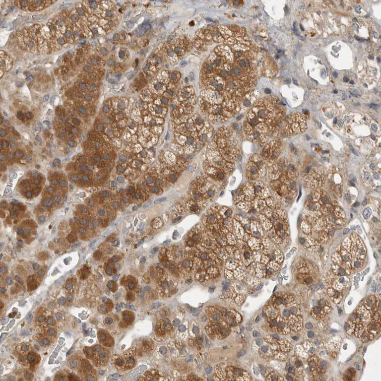 Immunohistochemistry (Formalin/PFA-fixed paraffin-embedded sections) - Anti-VEPH1 antibody (AB121875)