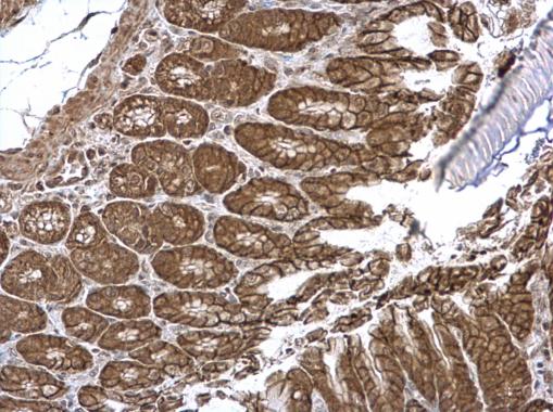 Immunohistochemistry (Formalin/PFA-fixed paraffin-embedded sections) - Anti-VEPH1 antibody - N-terminal (AB229237)