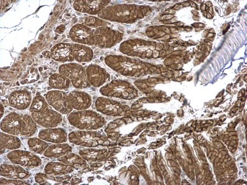 Immunohistochemistry (Formalin/PFA-fixed paraffin-embedded sections) - Anti-VEPH1 antibody - N-terminal (AB229237)