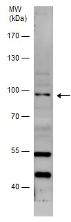 Western blot - Anti-VEPH1 antibody - N-terminal (AB229237)