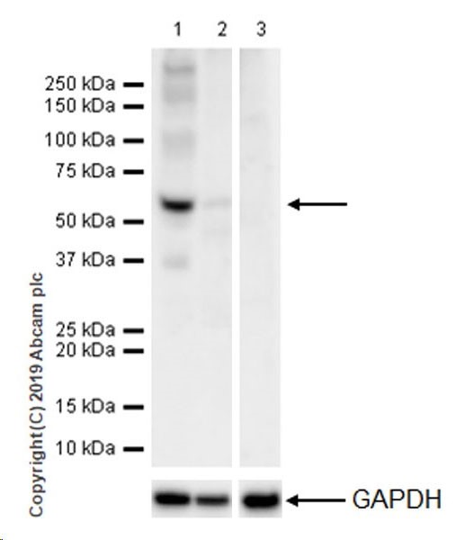 Western blot - VeriBlot for IP Detection Reagent (HRP) (ab131366), expandable thumbnail