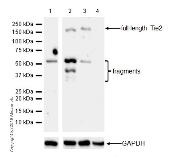 Western blot - VeriBlot for IP Detection Reagent (HRP) (ab131366), expandable thumbnail