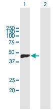 Western blot - Anti-Versican antibody (AB171887)