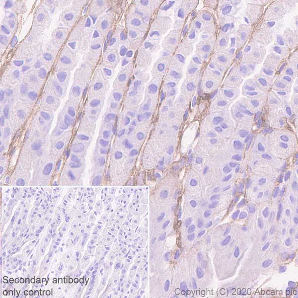 Immunohistochemistry (Formalin/PFA-fixed paraffin-embedded sections) - Anti-Versican antibody [EPR23135-58] (AB269270), expandable thumbnail