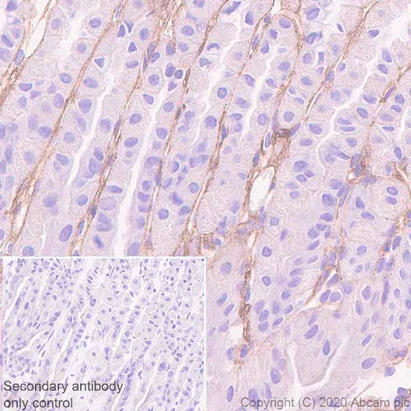 Immunohistochemistry (Formalin/PFA-fixed paraffin-embedded sections) - Anti-Versican antibody [EPR23135-58] (AB269270)