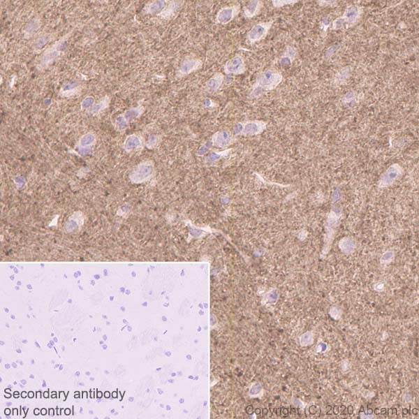 Immunohistochemistry (Formalin/PFA-fixed paraffin-embedded sections) - Anti-Versican antibody [EPR23135-58] (AB269270), expandable thumbnail