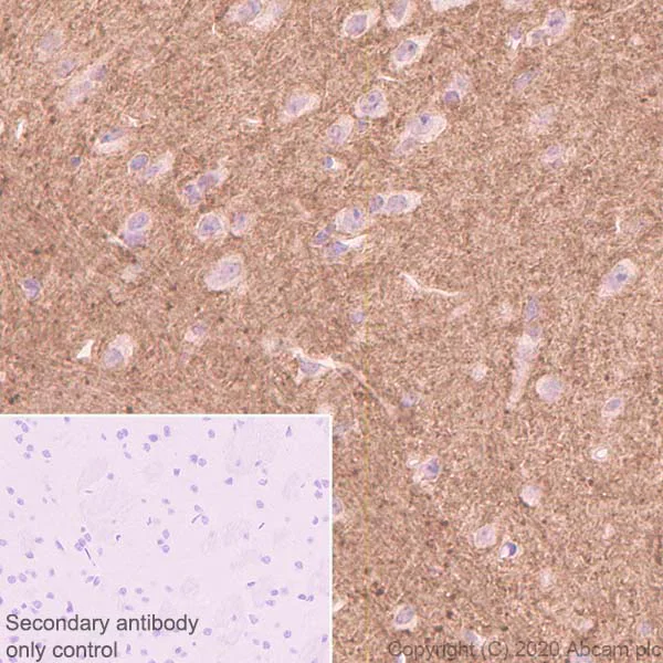 Immunohistochemistry (Formalin/PFA-fixed paraffin-embedded sections) - Anti-Versican antibody [EPR23135-58] (AB269270)
