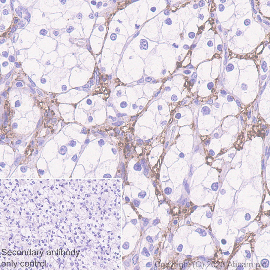 Immunohistochemistry (Formalin/PFA-fixed paraffin-embedded sections) - Anti-Versican antibody [EPR23135-58] (ab269270), expandable thumbnail
