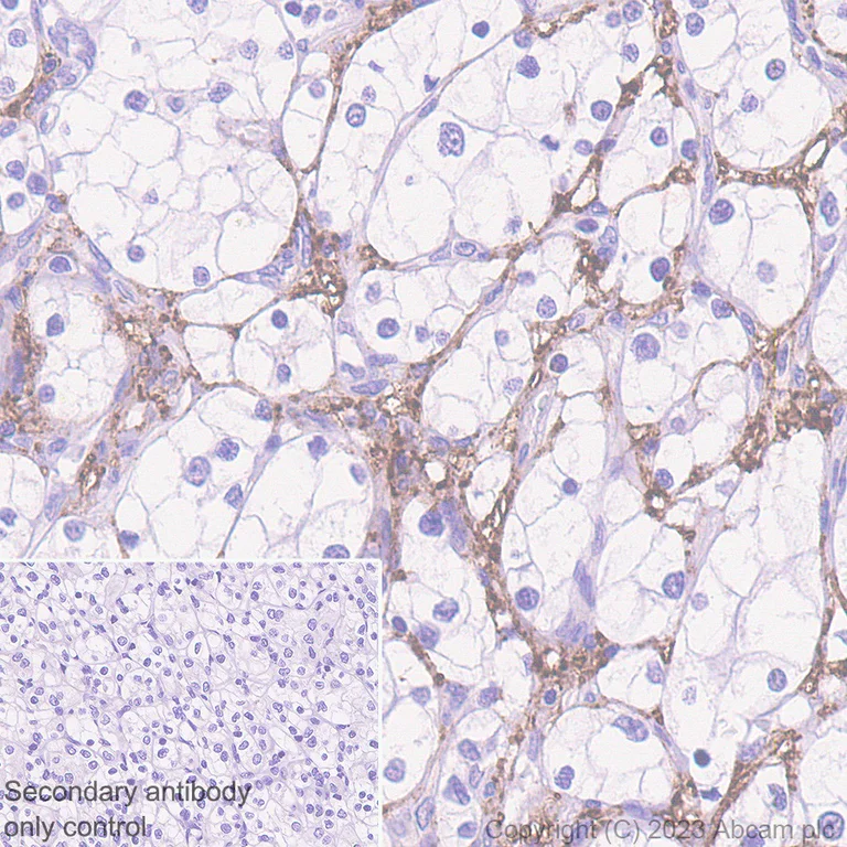 Immunohistochemistry (Formalin/PFA-fixed paraffin-embedded sections) - Anti-Versican antibody [EPR23135-58] (AB269270)