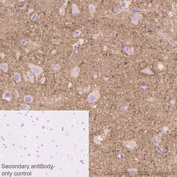 Immunohistochemistry (Formalin/PFA-fixed paraffin-embedded sections) - Anti-Versican antibody [EPR23135-58] (AB269270), expandable thumbnail
