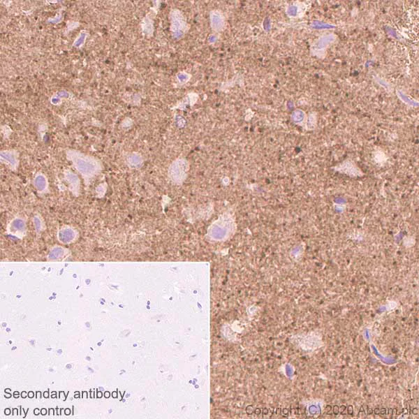 Immunohistochemistry (Formalin/PFA-fixed paraffin-embedded sections) - Anti-Versican antibody [EPR23135-58] (AB269270)