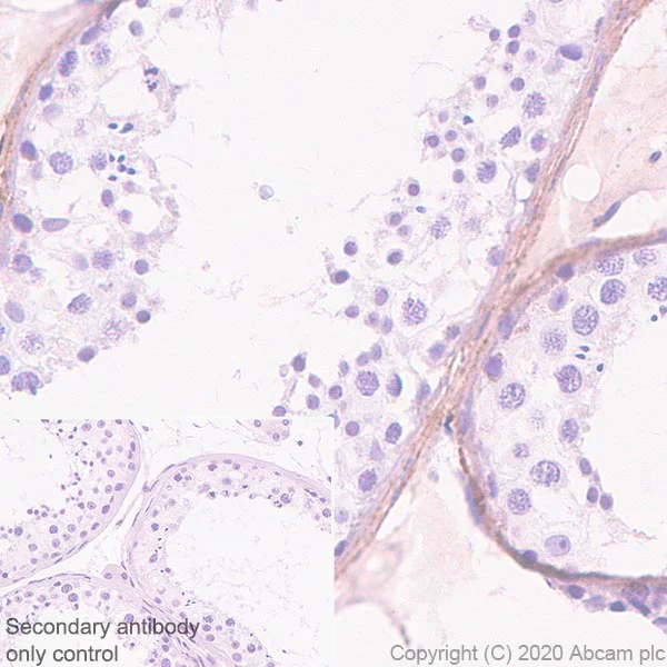 Immunohistochemistry (Formalin/PFA-fixed paraffin-embedded sections) - Anti-Versican antibody [EPR23135-58] (AB269270)