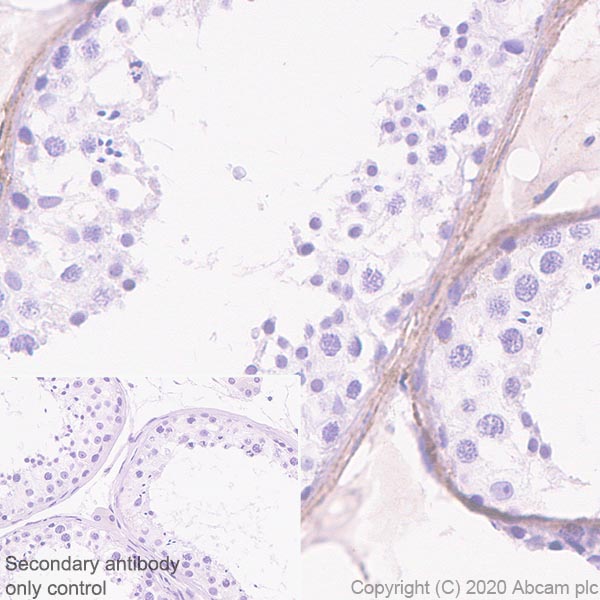 Immunohistochemistry (Formalin/PFA-fixed paraffin-embedded sections) - Anti-Versican antibody [EPR23135-58] - BSA and Azide free (AB272178)