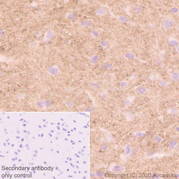 Immunohistochemistry (Formalin/PFA-fixed paraffin-embedded sections) - Anti-Versican antibody [EPR23374-151] (AB270445)