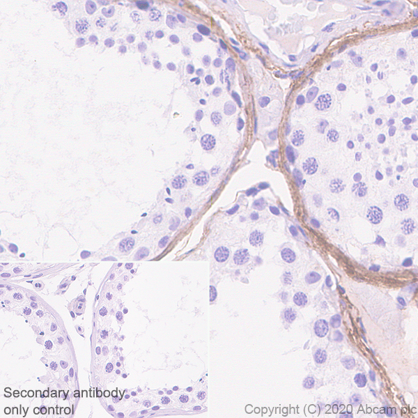 Immunohistochemistry (Formalin/PFA-fixed paraffin-embedded sections) - Anti-Versican antibody [EPR23374-151] (AB270445)
