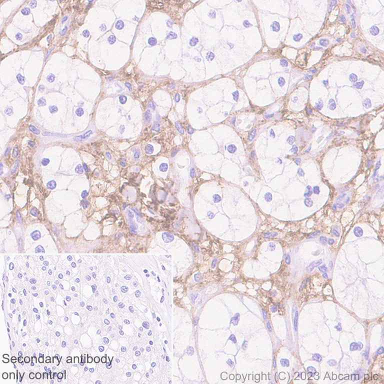 Immunohistochemistry (Formalin/PFA-fixed paraffin-embedded sections) - Anti-Versican antibody [EPR23374-151] (AB270445)