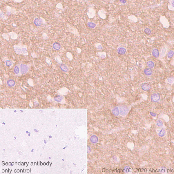 Immunohistochemistry (Formalin/PFA-fixed paraffin-embedded sections) - Anti-Versican antibody [EPR23374-151] (AB270445)