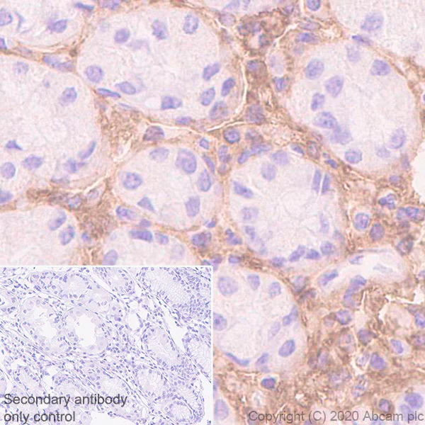 Immunohistochemistry (Formalin/PFA-fixed paraffin-embedded sections) - Anti-Versican antibody [EPR23374-151] (AB270445)
