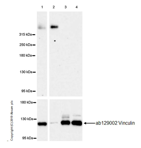 Western blot - Anti-Versican antibody [EPR23374-151] (AB270445)