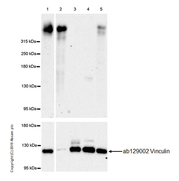 Western blot - Anti-Versican antibody [EPR23374-21] (AB270444), expandable thumbnail