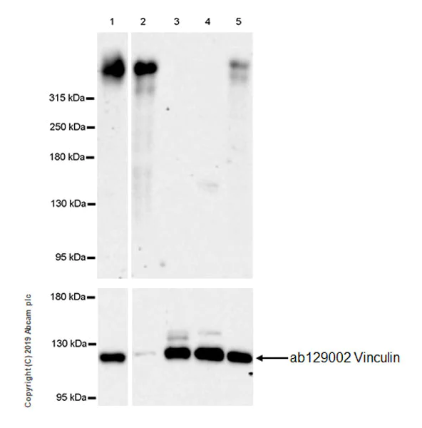 Western blot - Anti-Versican antibody [EPR23374-21] (AB270444)