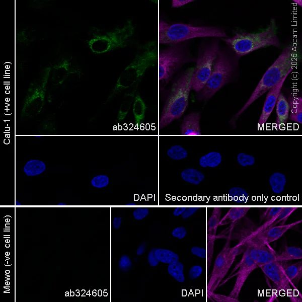 Immunocytochemistry/ Immunofluorescence - Anti-Versican antibody [RM1301] (AB324605)