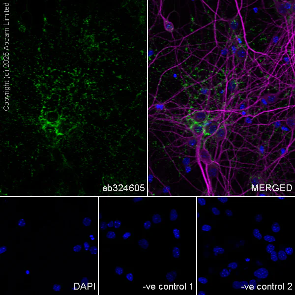 Immunocytochemistry/ Immunofluorescence - Anti-Versican antibody [RM1301] (AB324605)