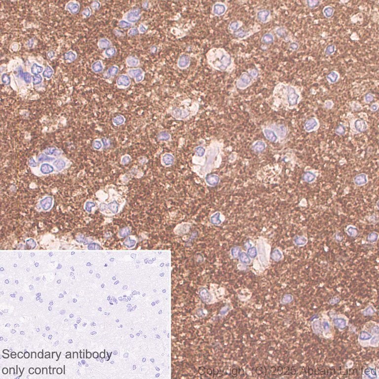 Immunohistochemistry (Formalin/PFA-fixed paraffin-embedded sections) - Anti-Versican antibody [RM1301] (AB324605)