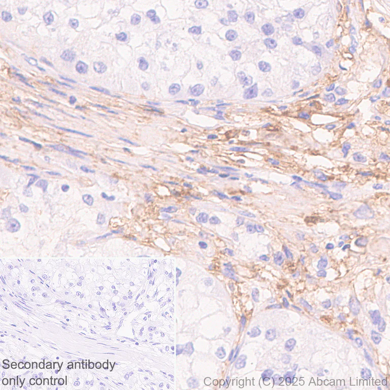 Immunohistochemistry (Formalin/PFA-fixed paraffin-embedded sections) - Anti-Versican antibody [RM1301] (AB324605)
