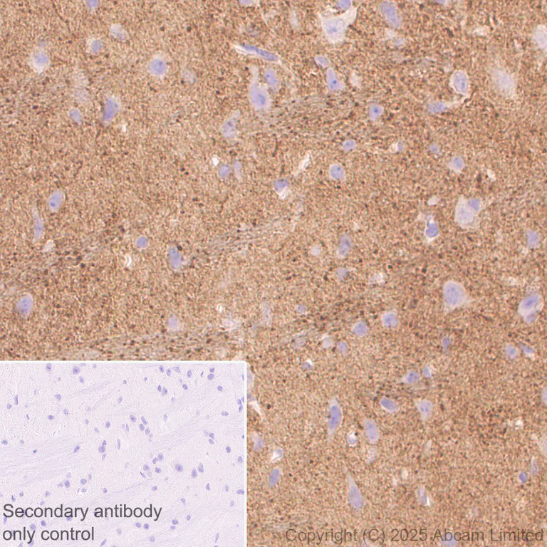 Immunohistochemistry (Formalin/PFA-fixed paraffin-embedded sections) - Anti-Versican antibody [RM1301] (AB324605)